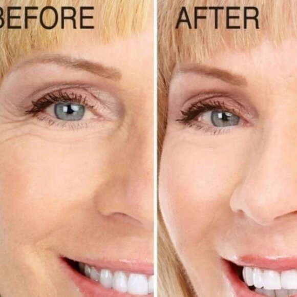 Advanced Clinicals Hyaluronic Serum Instant Skin Hydrator 1.75 FL Oz🆕⌚🏃💨🚚 - Picture 4 of 16